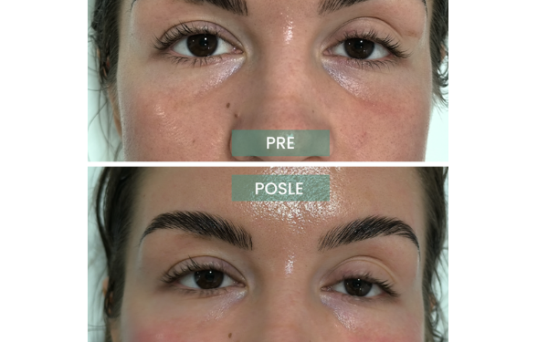 Nucleofill Eyes preposle